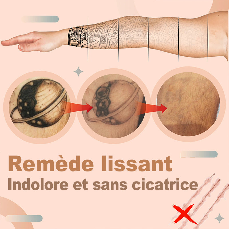 Crème de Détatouage