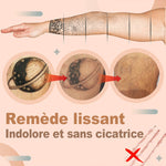 Crème de Détatouage
