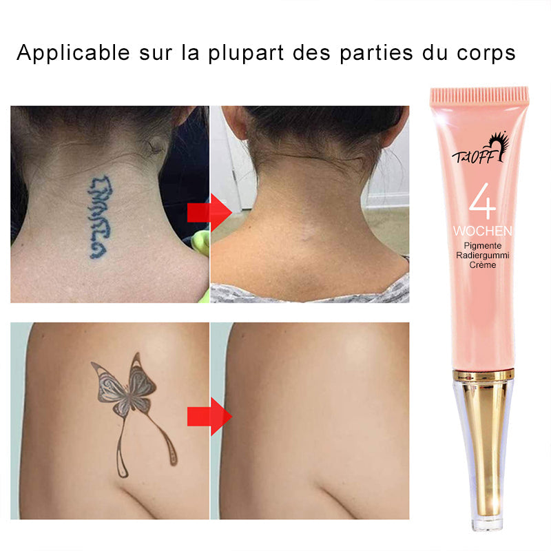 Crème de Détatouage