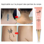 Crème de Détatouage